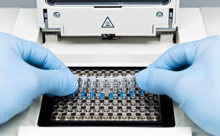 Scientist Extracting a Rack Tube With Urine Samples. Closeup of a Scientist Working With Urine Samples in Lab.