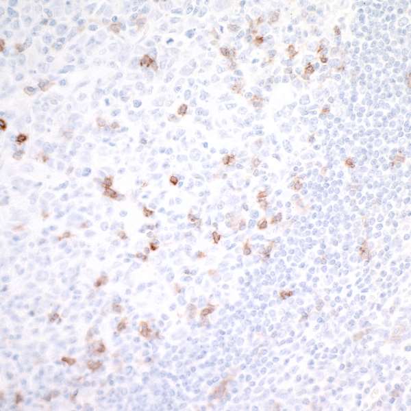 Detection of human GITR/TNFRSF18 in FFPE tonsil by IHC. 