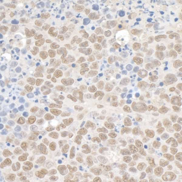 Detection of mouse Kap-1 by immunohistochemistry.