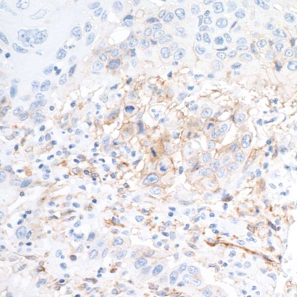Detection of human CD73 by immunohistochemistry.