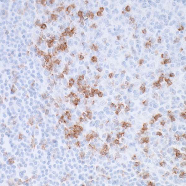 Detection of human PD-1 in FFPE tonsil by IHC.