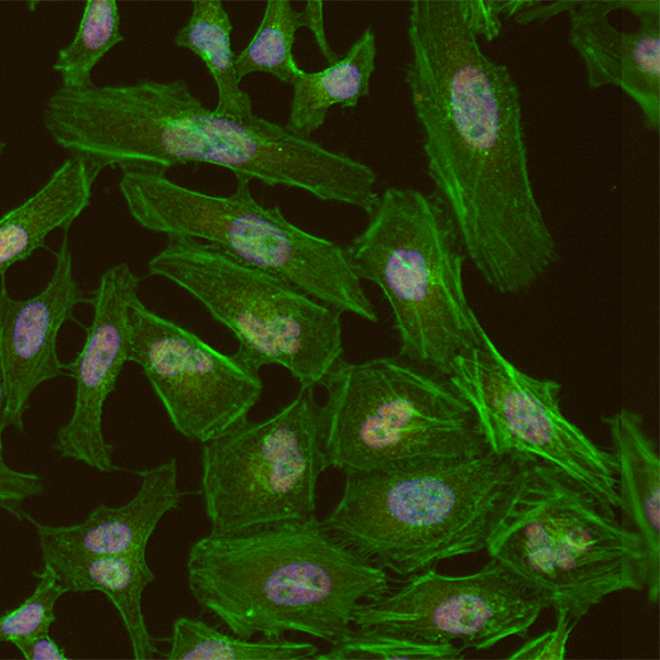 Detection of human BRD4 in formaldehyde-fixed HeLa cells by ICC-IF.