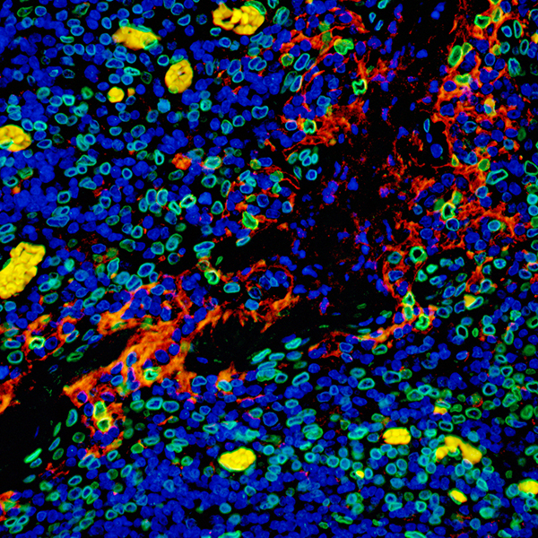 Detection of human PD-L1 (red) and Lamin-A/C (green) in FFPE tonsil by IHC-IF.