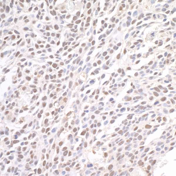 Detection of mouse BRD4 by immunohistochemistry.