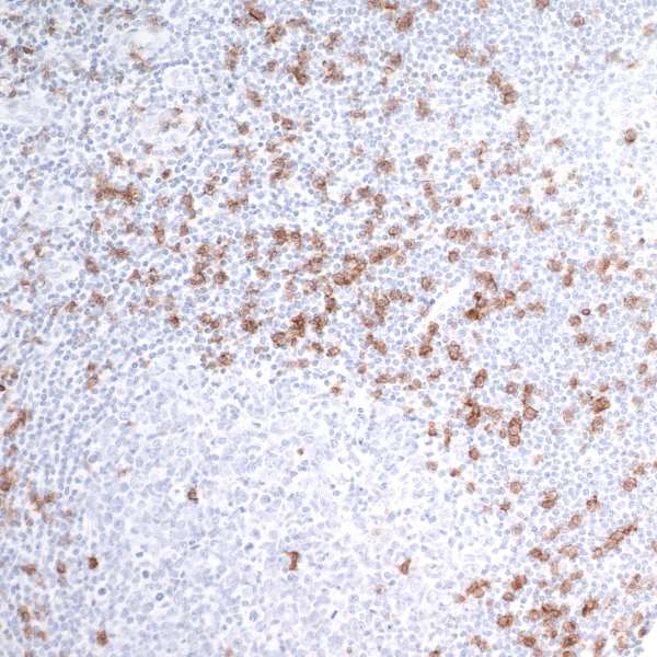 IHC-P of human tonsil with rabbit anti-CD8 alpha recombinant mAb [clone BLR044F], A700-044 and HRP conjugated anti-rabbit secondary antibody followed by DAB-based detection