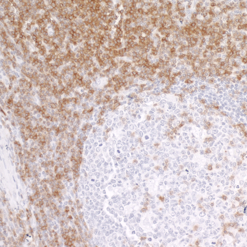 Detection of human CD247/CD3Z in FFPE tonsil IHC.
