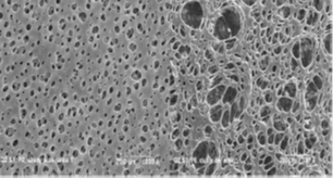 Primecare Blood Separation Membranes