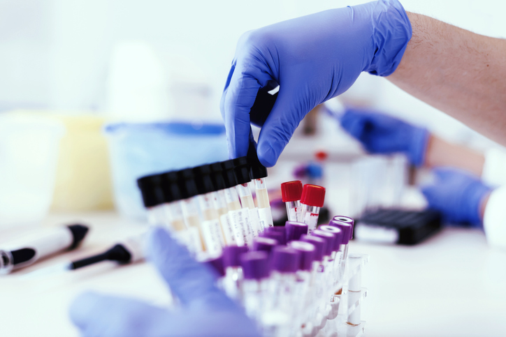 Scientist Extracting a Rack Tube With Urine Samples. Closeup of a Scientist Working With Urine Samples in Lab.