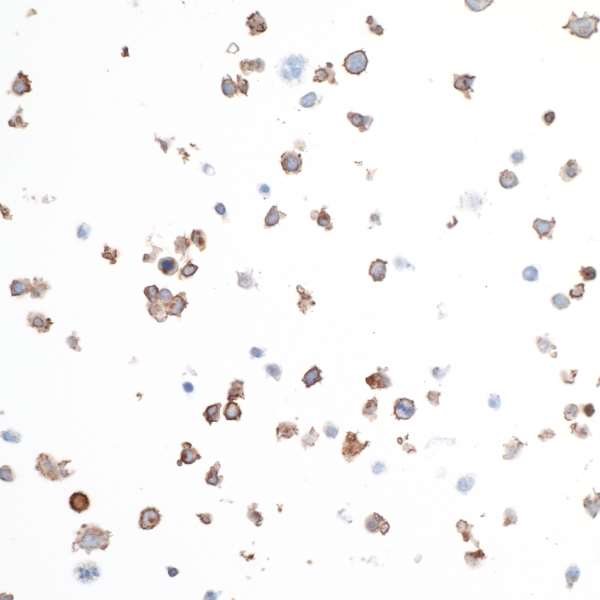 Detection of Human MCM3 by immunohistochemistry.