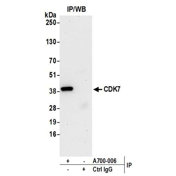 Detection of human CDK7 by WB of immunoprecipitates from HeLa lysate.