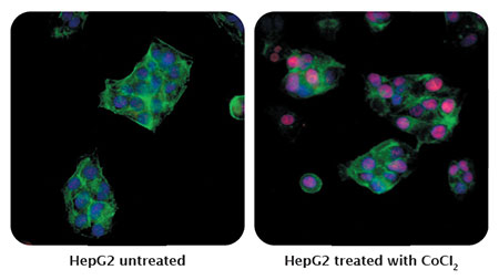Detection of human HIF2-alpha (red) in formaldehyde-fixed asynchronous HepG2 cells untreated (left) and treated with CoCI2 (right) by ICC-IF.