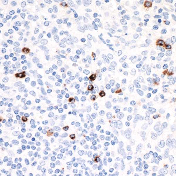 Detection of human LAG3 in FFPE tonsil by IHC.