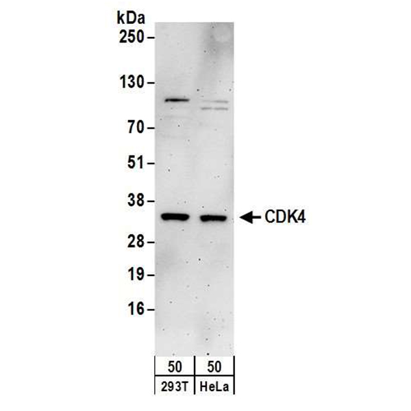Detection of human CDK4 by WB of 293T and HeLa lysate.
