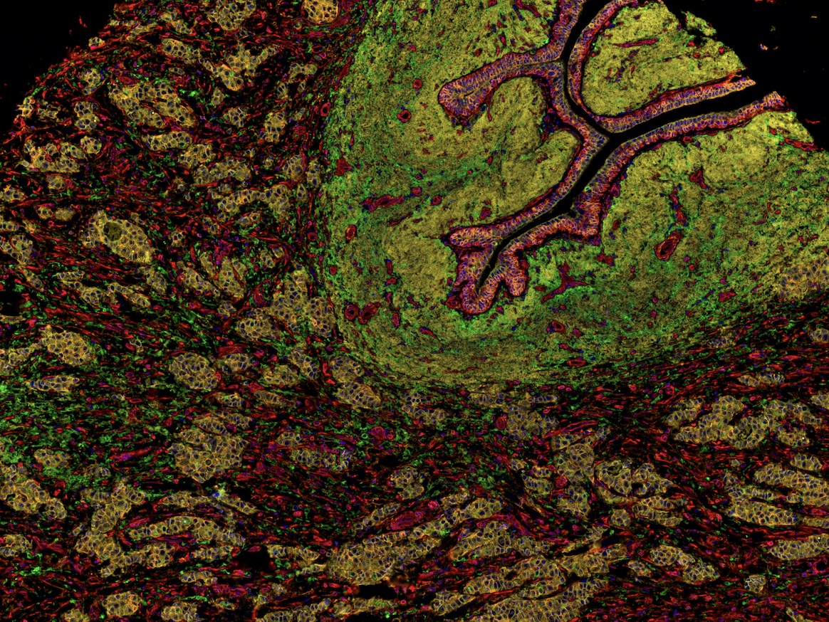 Focus on Autophagy