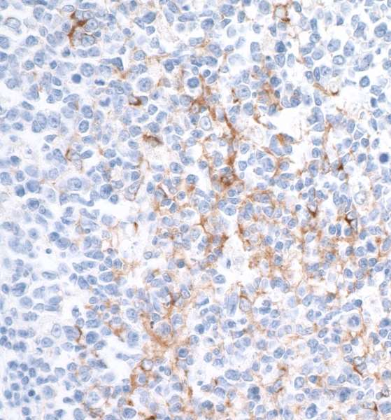 Detection of mouse MCM3 by immunohistochemistry.