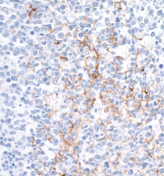 Detection of Human CD137 in FFPE tonsil by IHC.