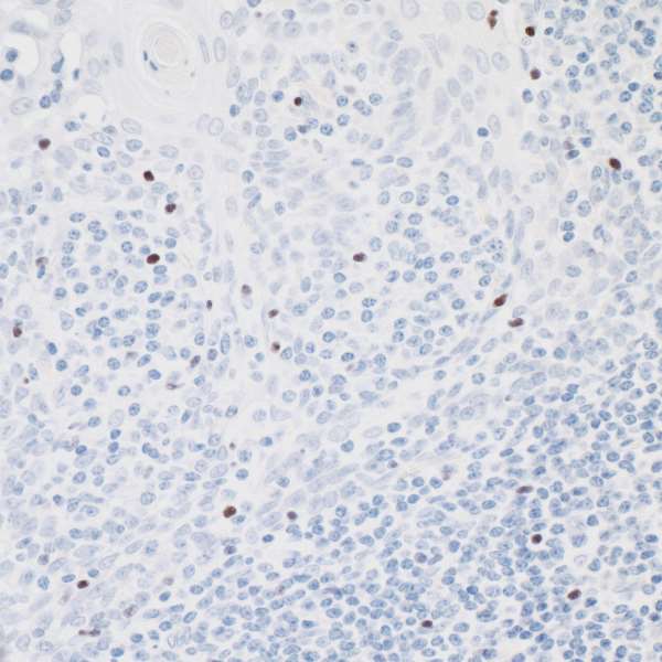 Detection of human FOXP3 in FFPE human tonsil by IHC