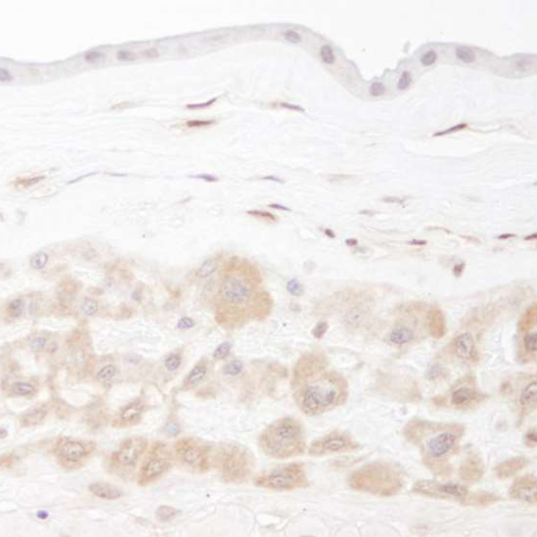 Detection of human PBEF in FFPE fetal membrane by IHC