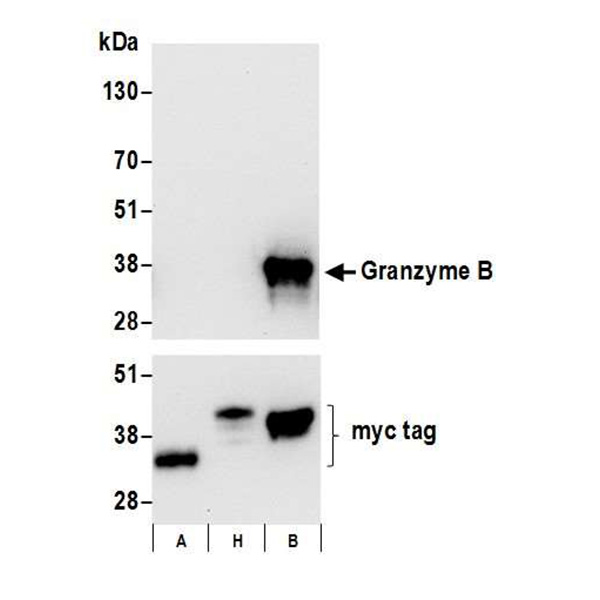 Detection of human Granzyme B by WB of myc-tagged Granzyme A, H, and B overexpressing cell lysate.