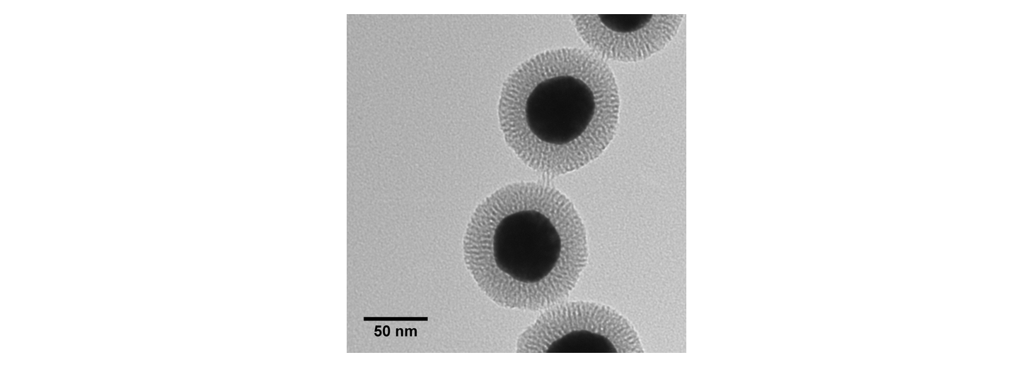 TEM image of 50 nm gold nanoparticles shelled with mesoporous silica