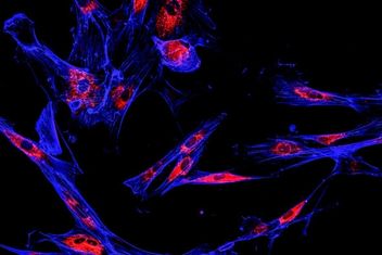 Immunofluorescence confocal imaging of melanoma cancer cells