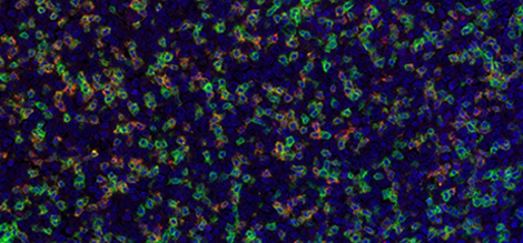 Detection of human CD3 (green), PD-1 (red), and PD-L1 (yellow) in FFPE tonsil by IHC-IF.