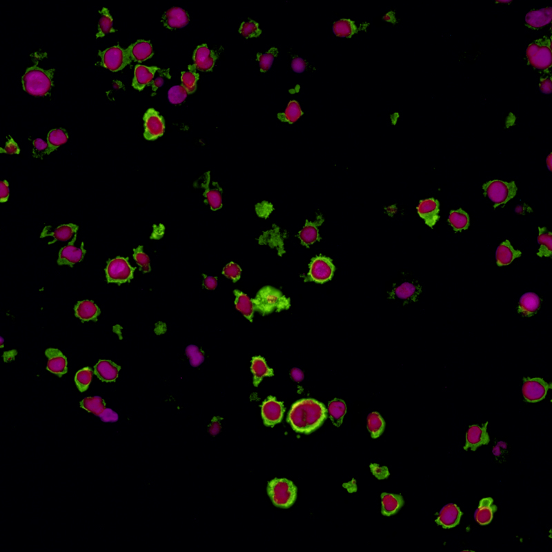 Detection of human LAG3 in HDLM2 cells by IHC (pseudocolor).