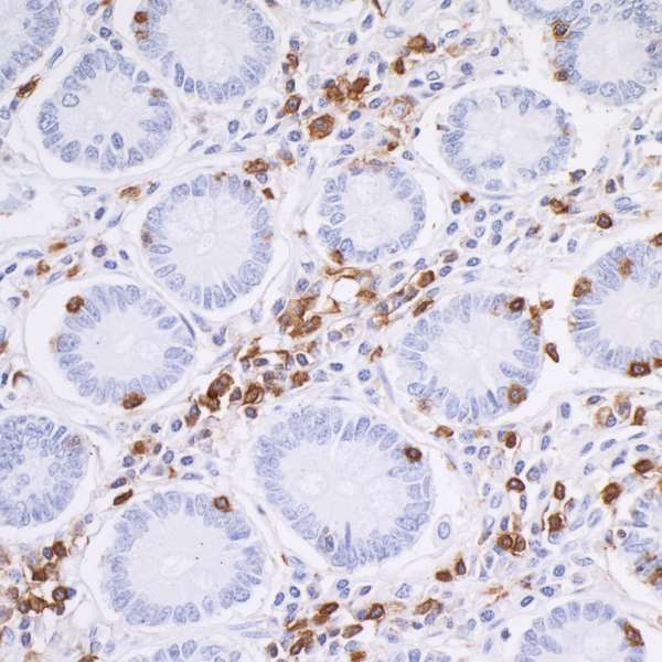 Detection of CD45 in a FFPE section of human small intestine by IHC.