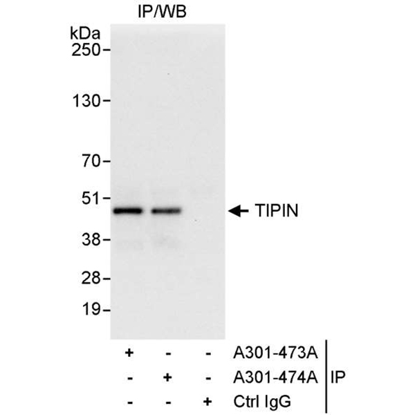 Detection human TIPIN by WB of immunoprecipitates from HeLa lysate.
