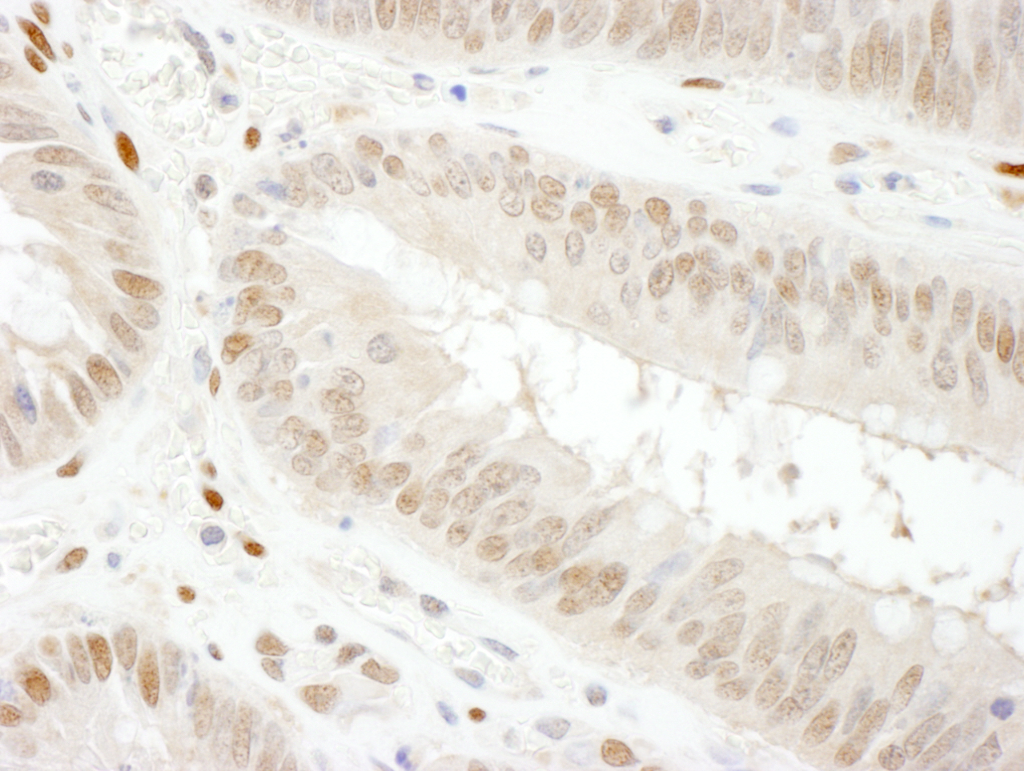 A303-878A