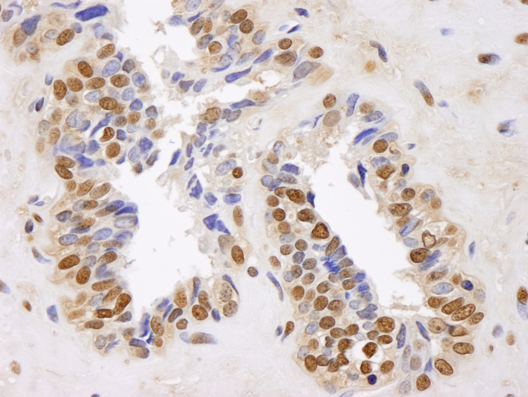 IHC-00096-T
