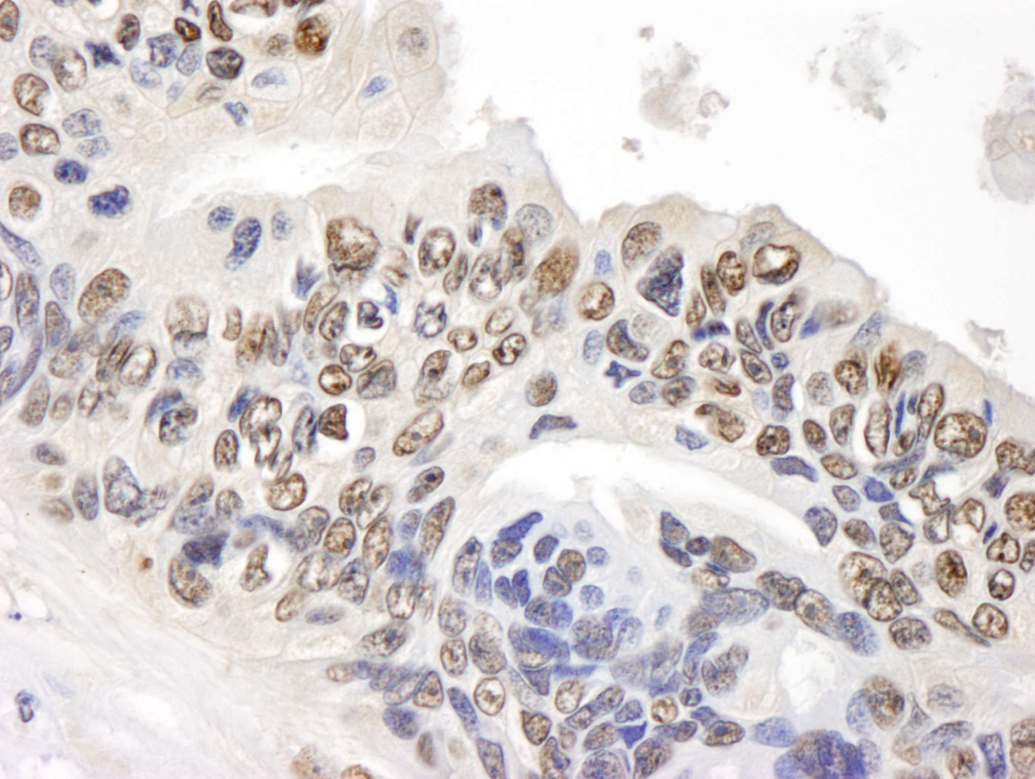 IHC-00097-T