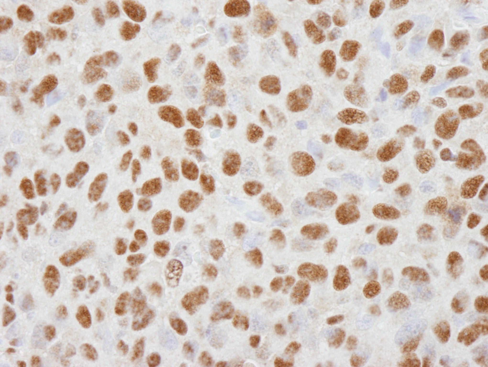 IHC-00056-T