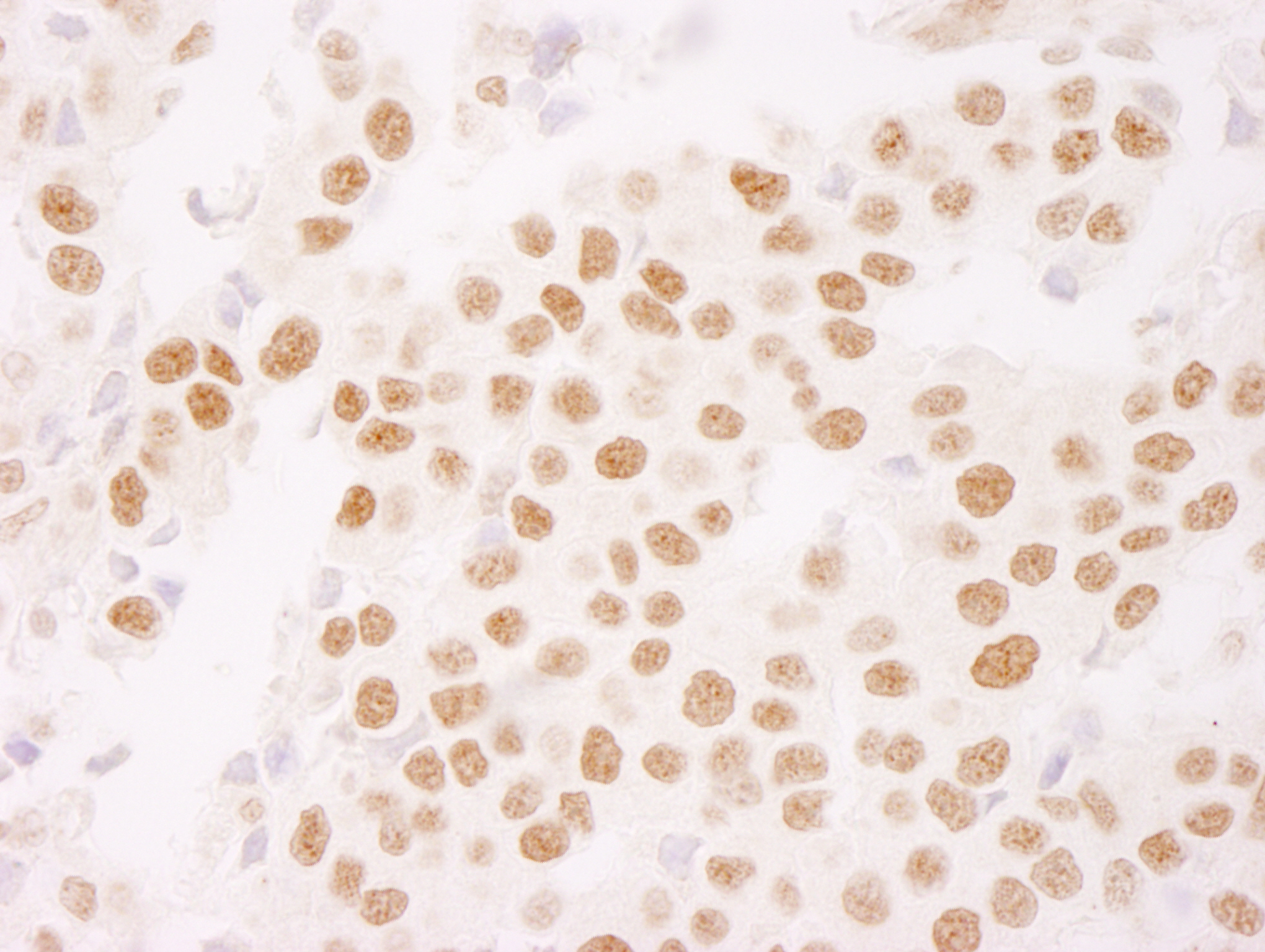 IHC-00395-T
