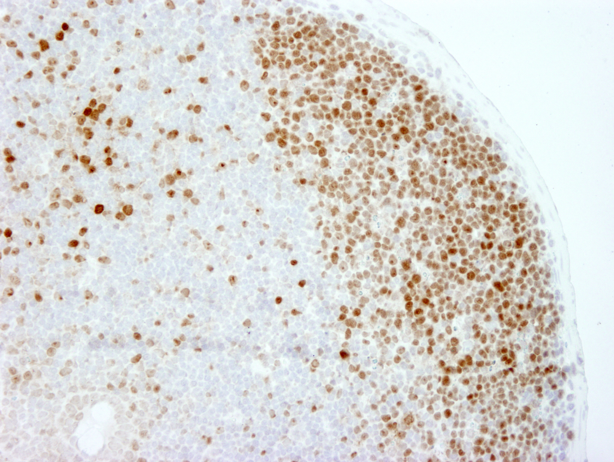 IHC-00375-T