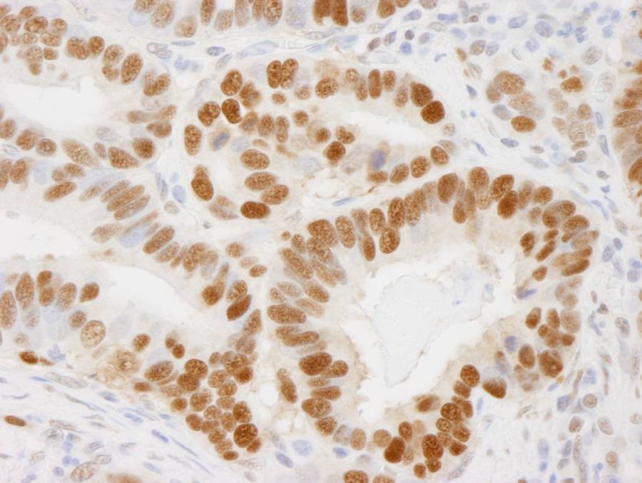 IHC-00012