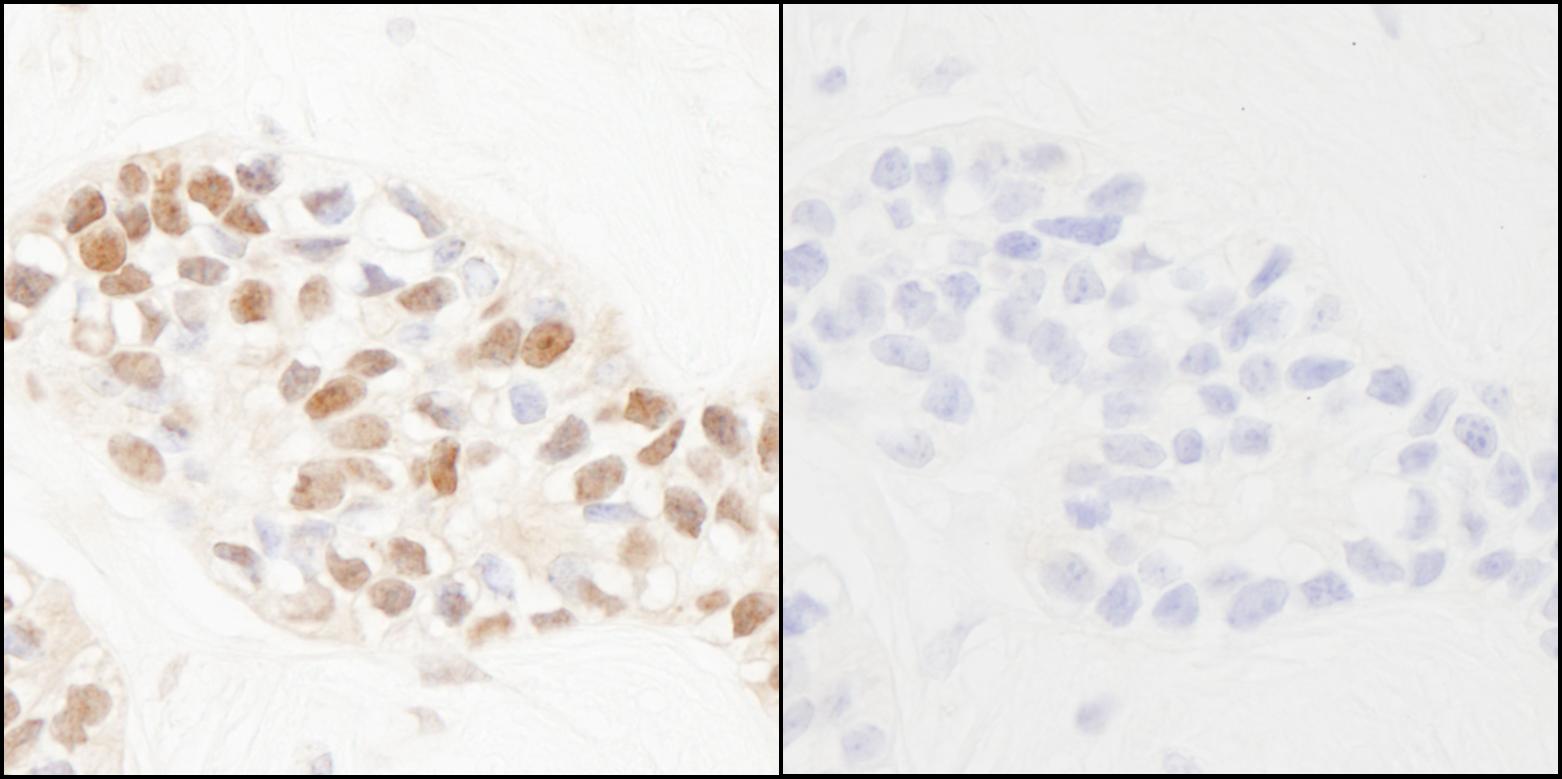 IHC-00219-T