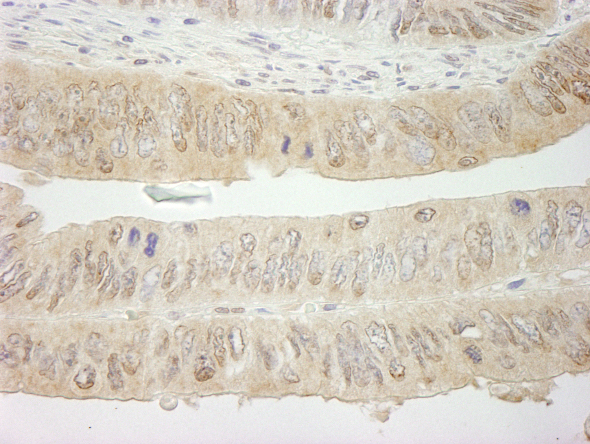 IHC-00443-T