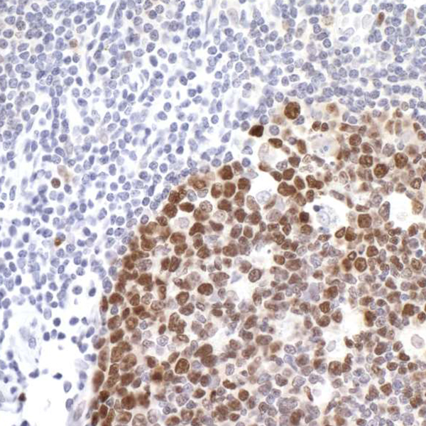 Detection of human Ki-67 in FFPE tonsil by IHC.