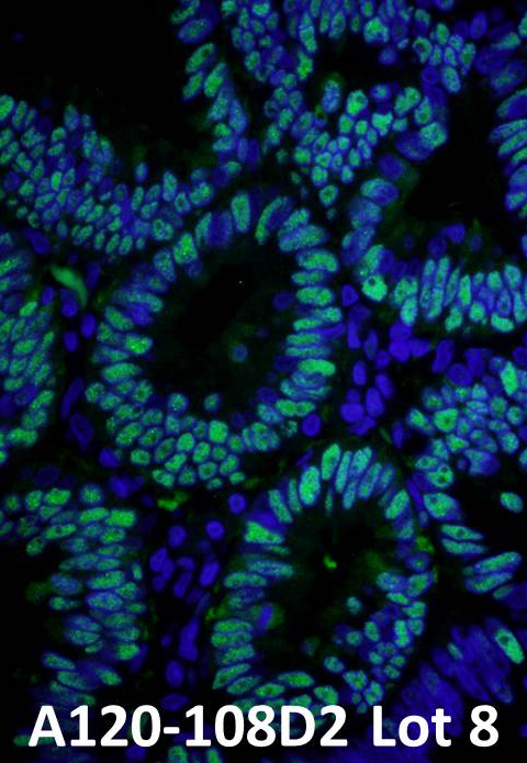 IHC using dylight conjugated conjugated antibody