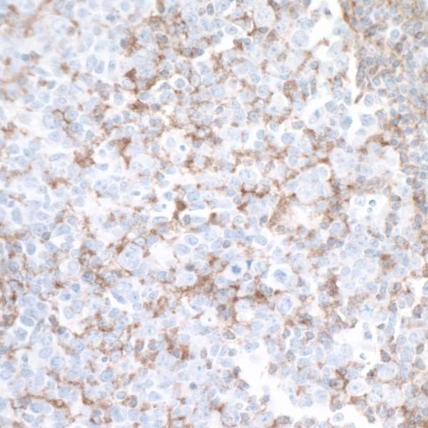 Detection of Human TIM3 in FFPE tonsil by IHC.