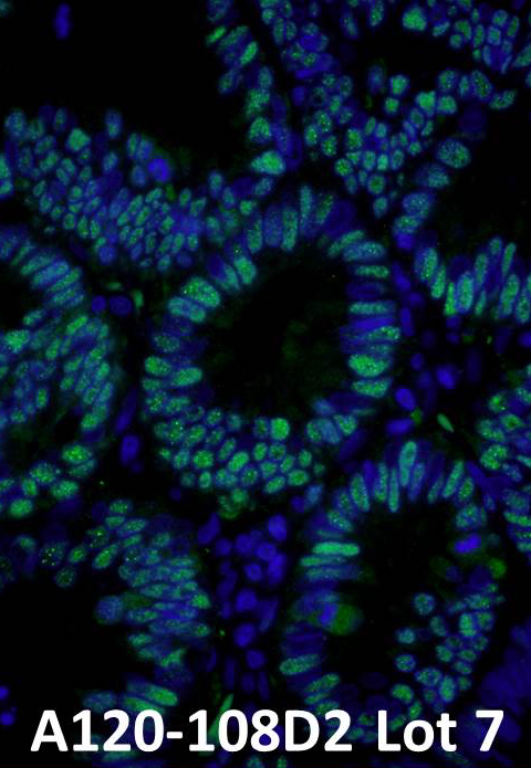 IHC using dylight conjugated conjugated antibody