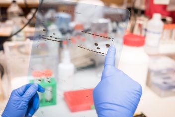 Researcher checking gel results