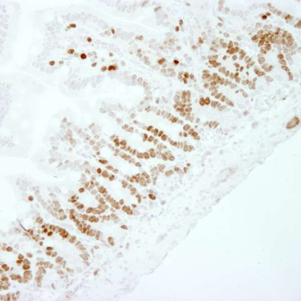 Detection of mouse Ki-67 in FFPE mouse intestine by IHC.
