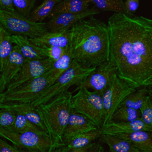 Detection of human KIF14 (orange) in formaldehyde-fixed HeLa cells by ICC-IF.