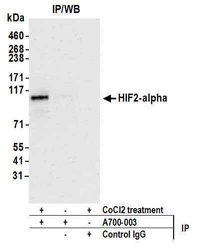 Detection of human HIF2-alpha by WB of immunoprecipitates from HEPG2 lysate treated with 200 µM CoCl2 (+) or mock treated (-).
