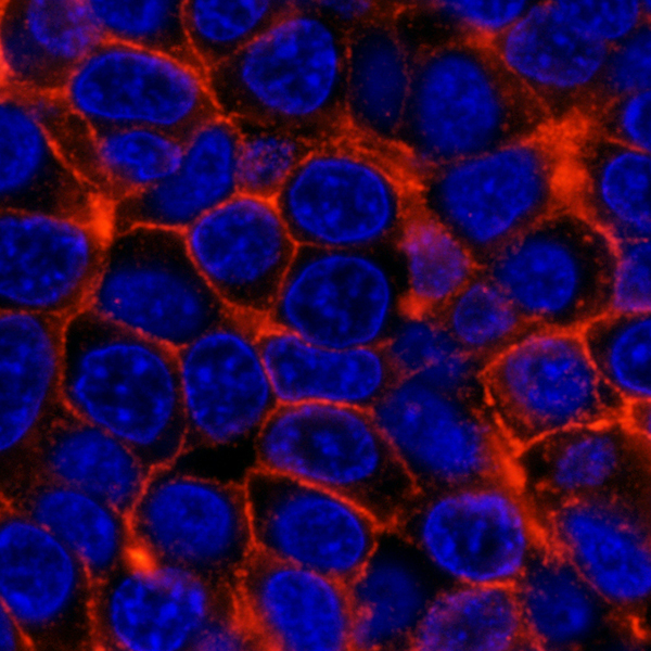 Detection of human ErbB2 (red), commonly referred to as HER2, in FFPE human breast carcinoma by IHC-IF.