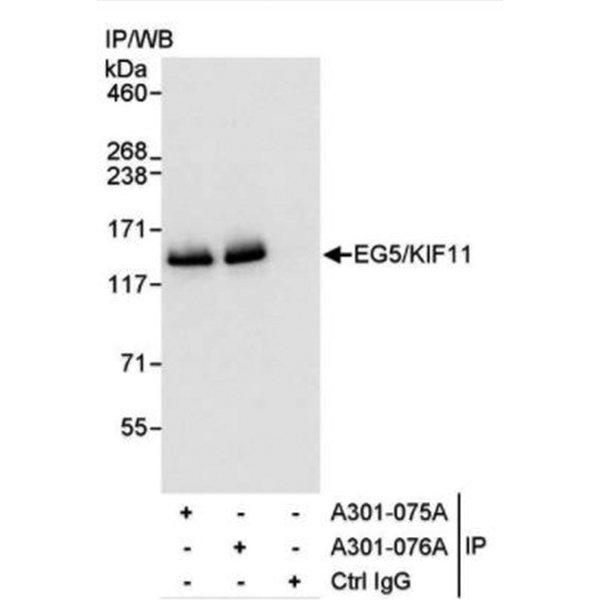 Detection of human EG5/KIF11 by WB of immunoprecipitates from 293T lysate.