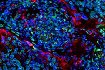 Multicolor immunohistochemistry (mIHC) staining with PathPlex® Multiplex Antibodies