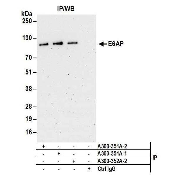 Detection of human E6AP/UBE3A by WB of immunoprecipitates from 293T, HeLa, and Jurkat lysate.